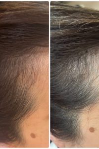 D5845460-C175-419A-B95D-5CDACF97A621